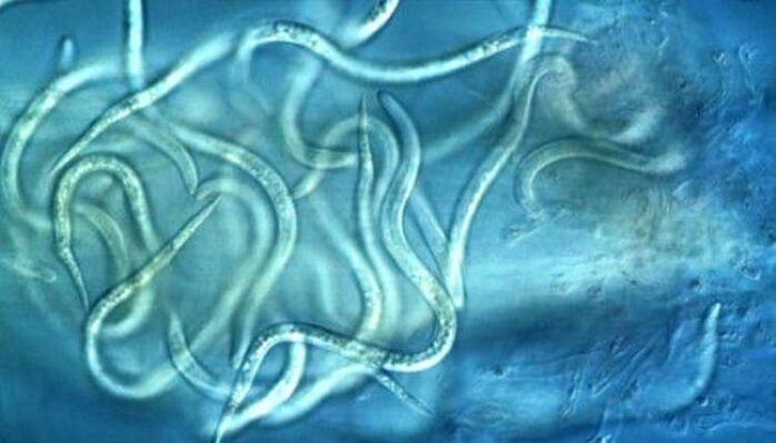 che aspetto hanno i parassiti nematodi nel corpo umano