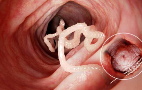il verme è un parassita nel corpo umano